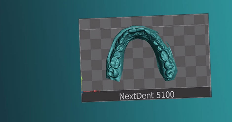A rendering of dentures