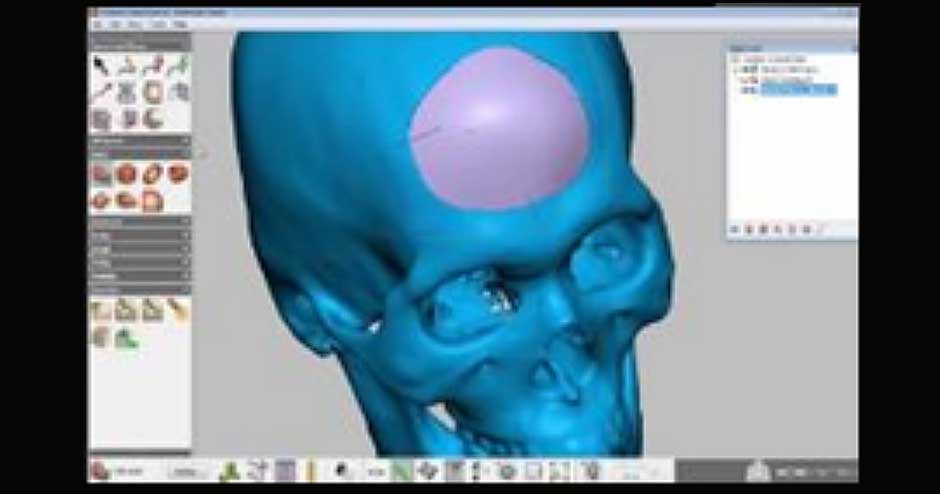 Anatomic Model Solutions | 3D Systems