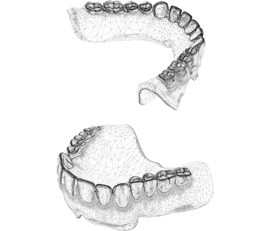 NextDent denture CAD file