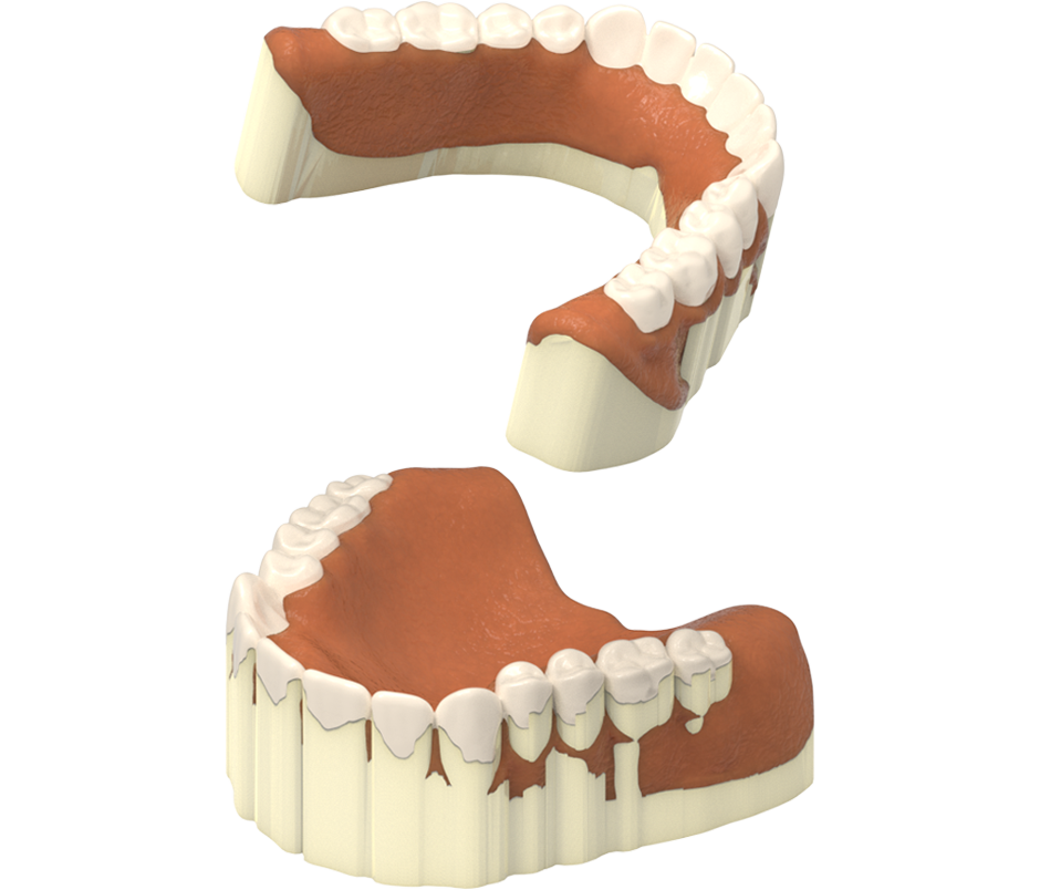 Printed denture with wax support on build platform