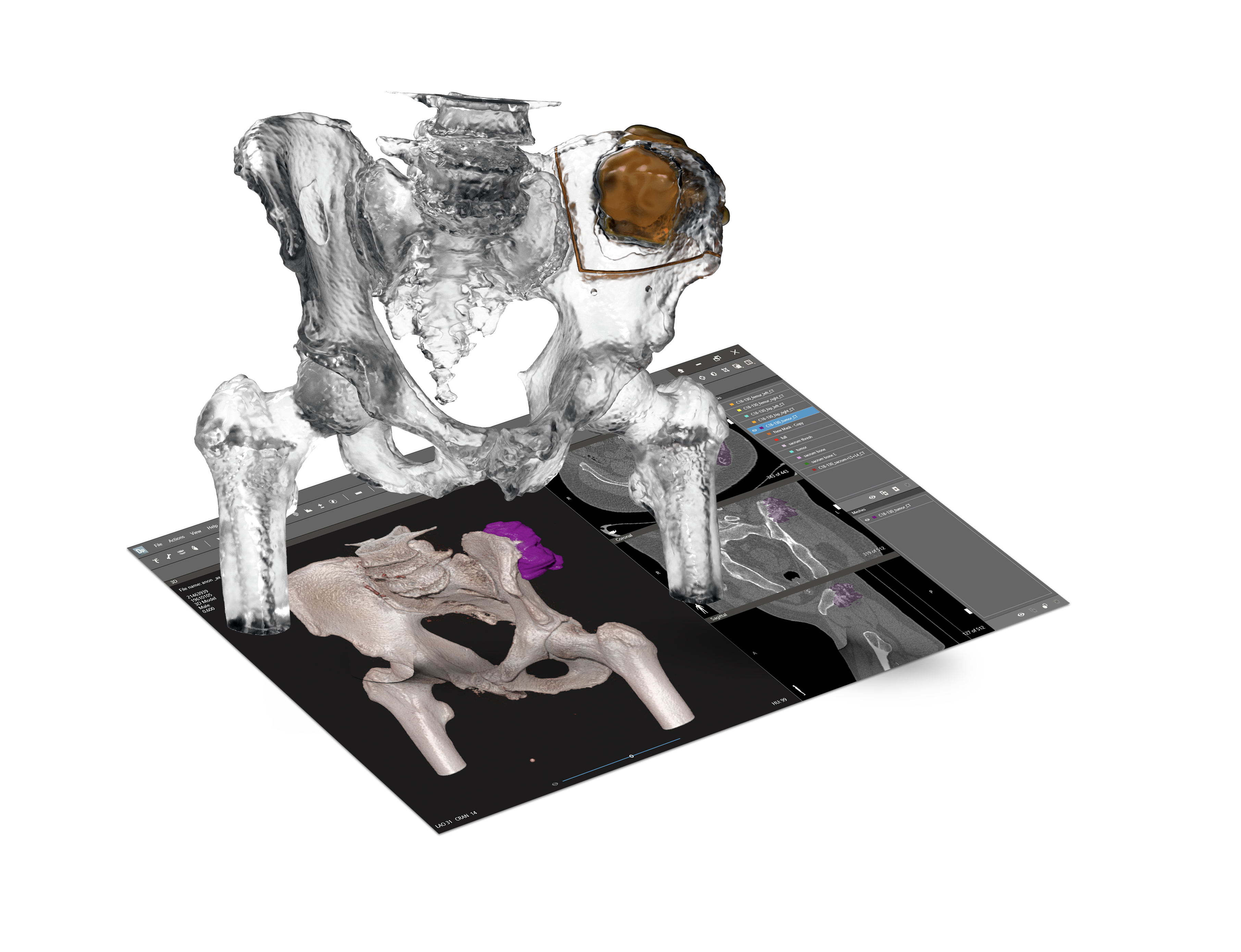 vsp orthopaedics