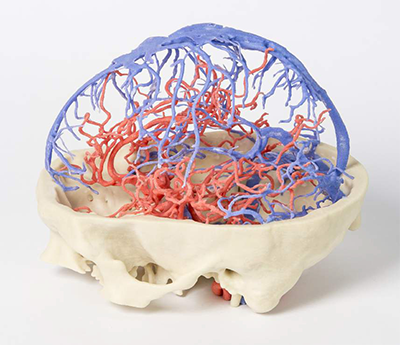 3D printed, full-color model of the brain highlights venous arterial circulation