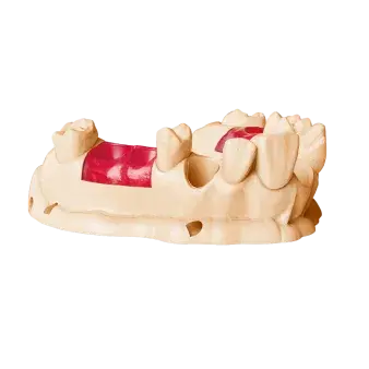 NextDent Gingiva Mask