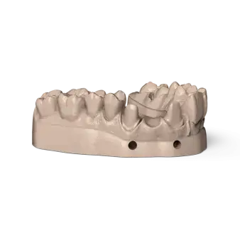 NextDent Model 
