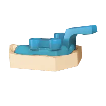 NextDent Tray hero