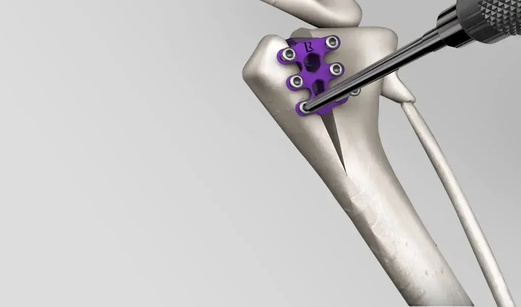 Customer Story 3D Metal Printing and Rita Leibinger Medical Get Disabled Dogs Back on their Feet Fast top banner