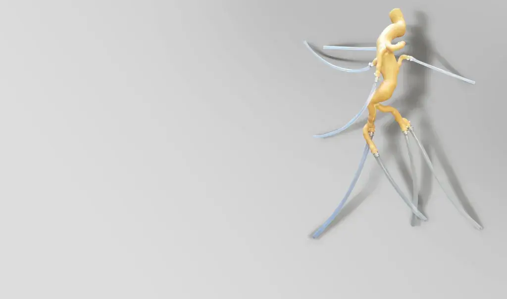 Customer Story Realistic FEVAR Hands-On Training Made Possible with 3D Printed Aortic Model Primary tabs View Edit(active tab) Delete Manage display Revisions top banner