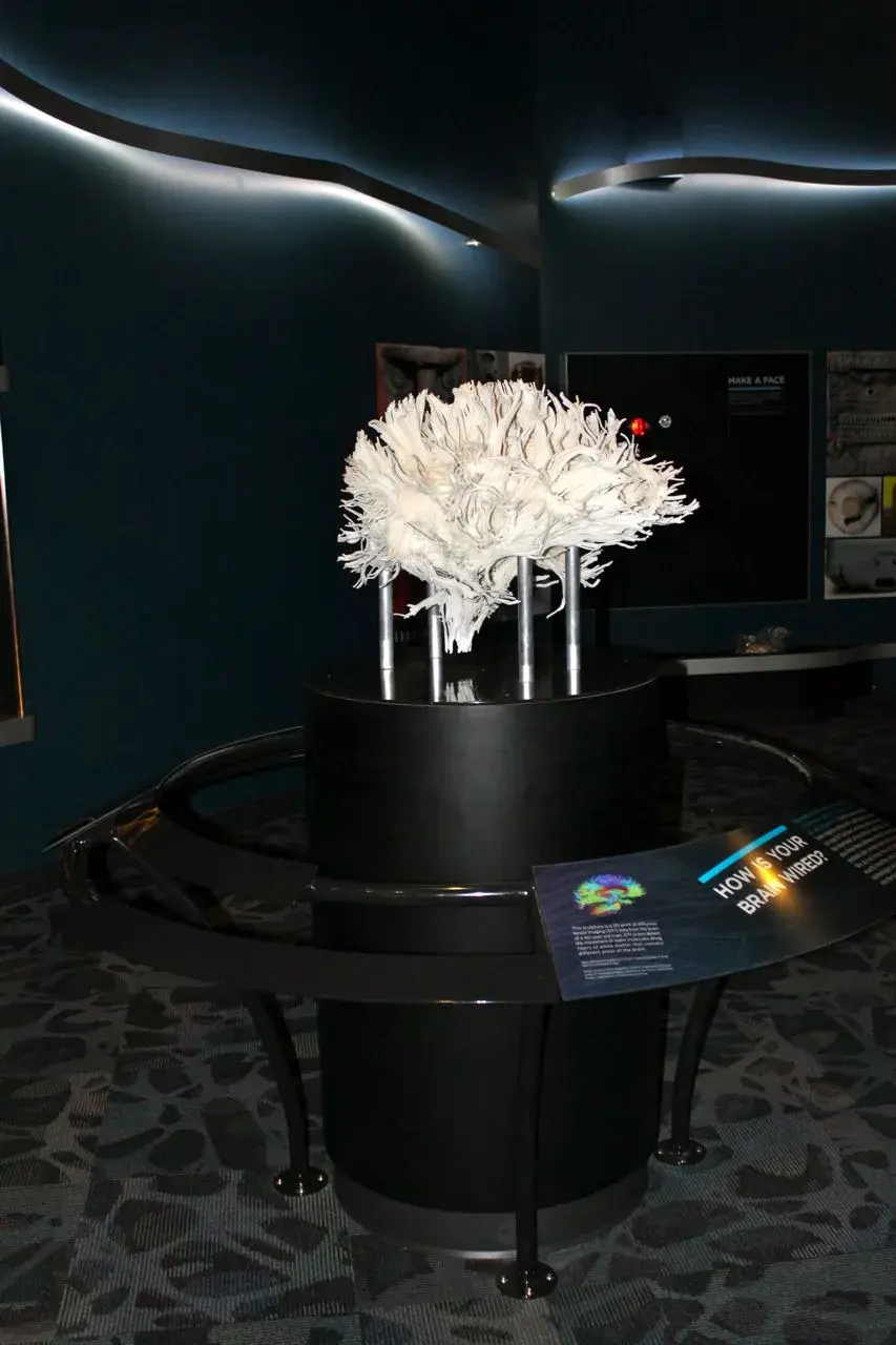 3D Printing the Mystery of the Brain003