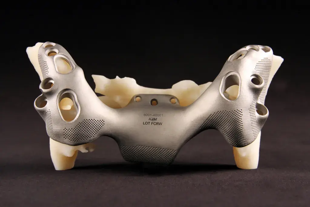 3d-systems-k2m-dmp-medical-device-patient-specific-implant-bone-model
