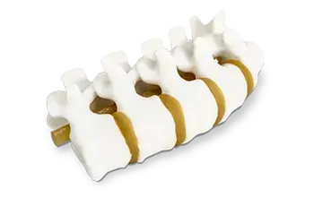 3D printed spine anatomical model by 3D Systems