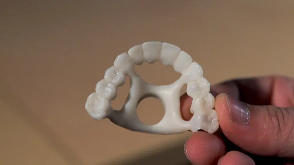 Hybrid Technologies 3D printed white digital wax up on NextDent 5100