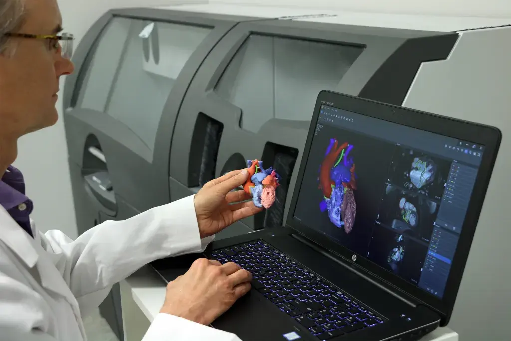 3D Systems’ D2P FDA cleared software allows clinicians to 3D print diagnostic patient-specific anatomic models.