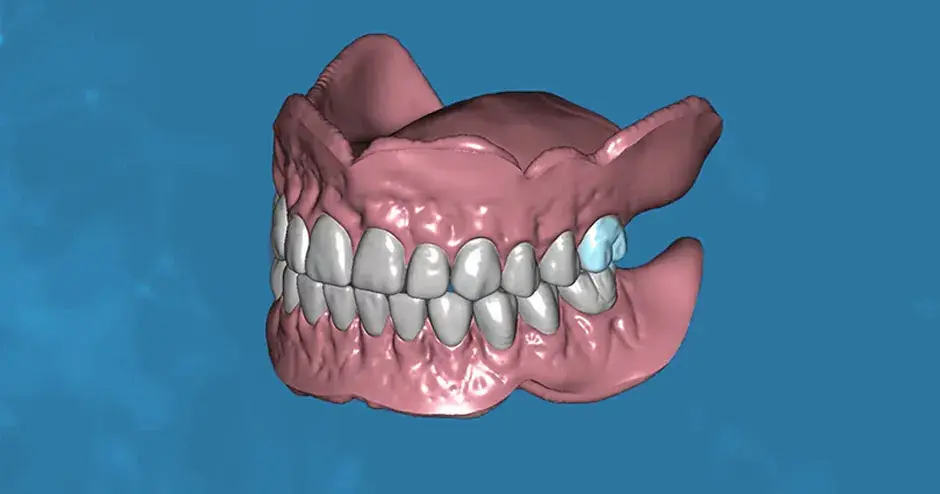 software showing a denture design