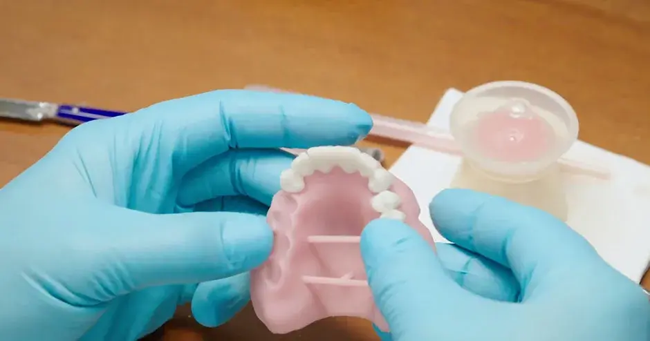 Prosthodontics Dentures 3D print