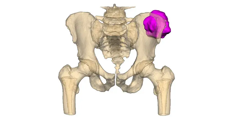a healthcare VSP Orthopaedics model