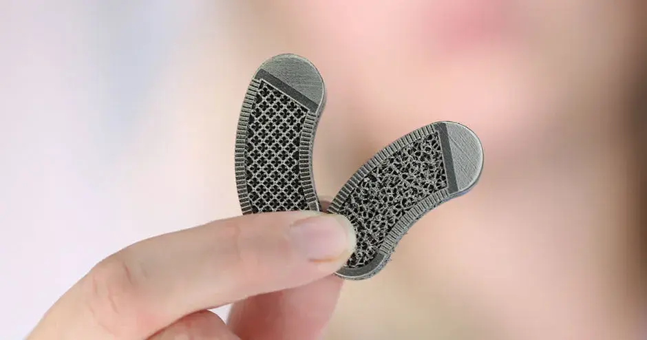 A 3D printed metal medical device implant
