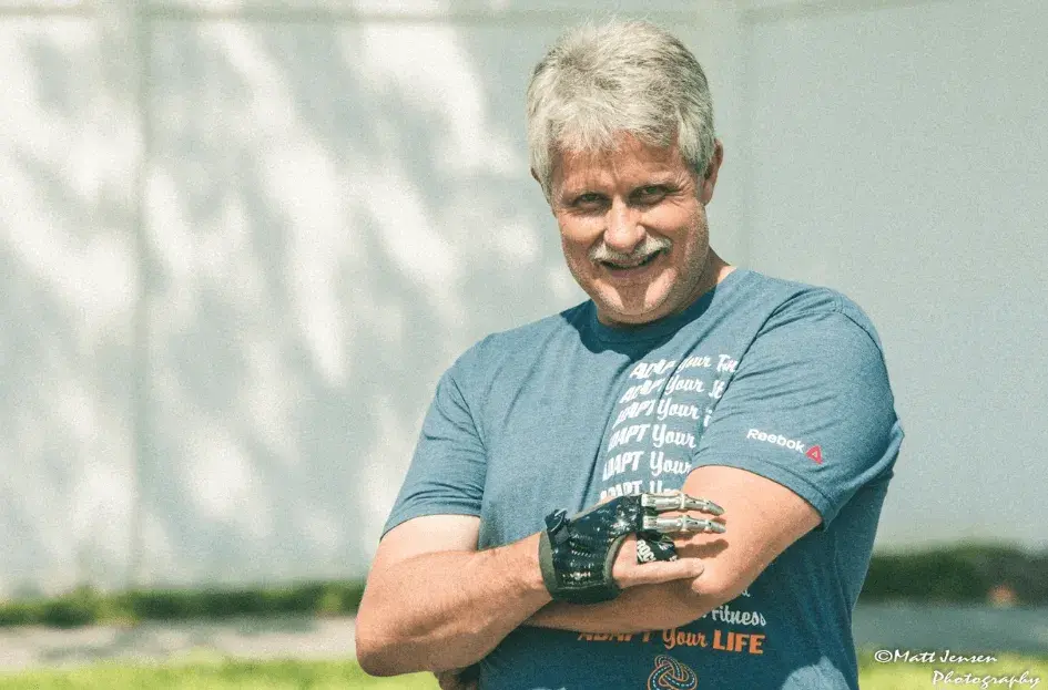 Jeff Soelberg wearing his partial hand prosthetic by Point Designs