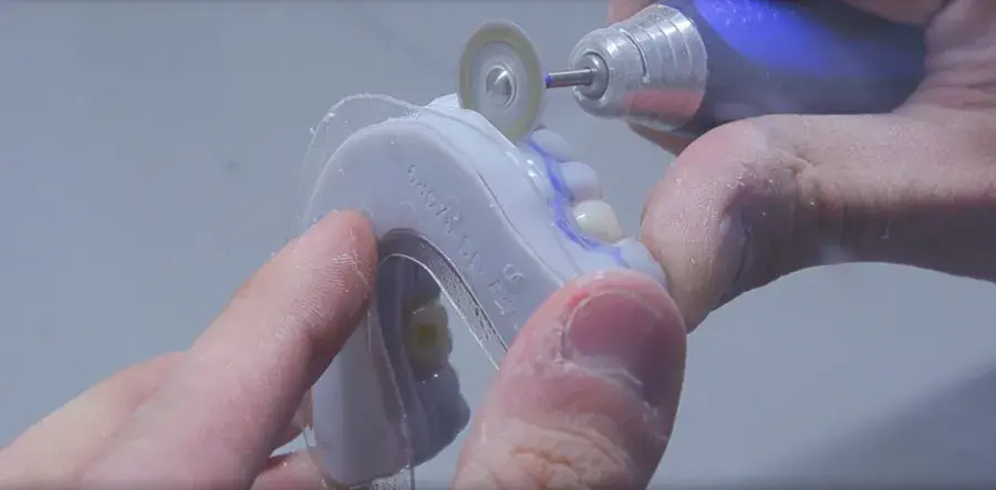 NEOLab and the NextDent 5100: Working Together Creating Perfect Smiles