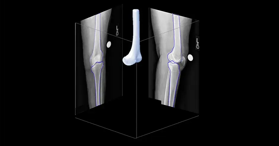 2D to 3D AI presentation