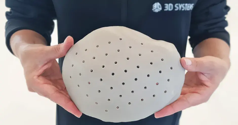 3 printed cranial implant