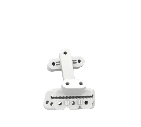 Vantage Coupled Curve Talus