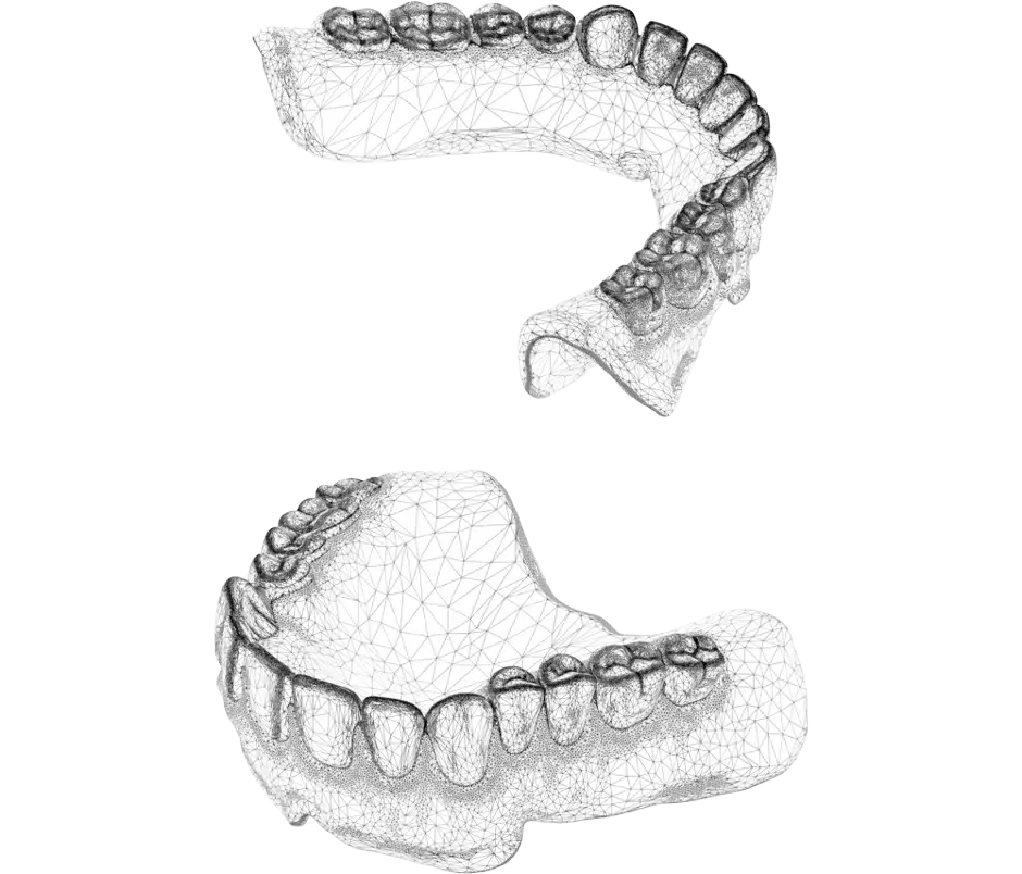 NextDent production CAD file