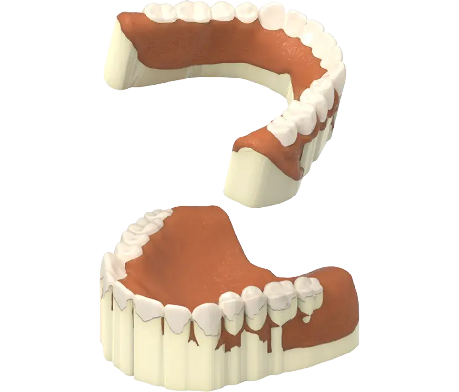 NextDent production remove support