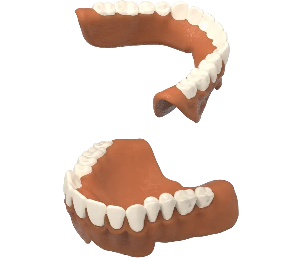 NextDent production wax has been removed