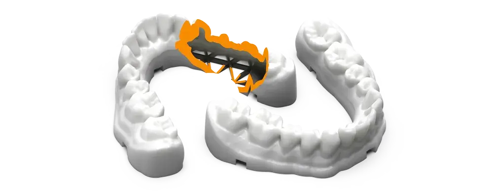 Trushell denture render