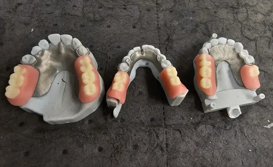 3D printed dental parts