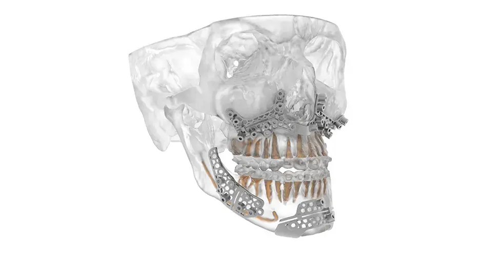 oral maxillofacial thumbnail