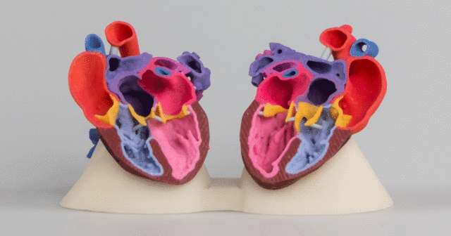 Free Anatomical Models For 3d Printing