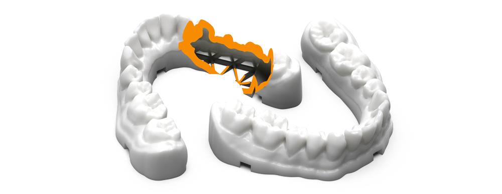 Trushell denture render