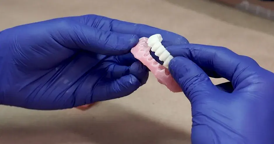 A dentist holding 3D printed dentures