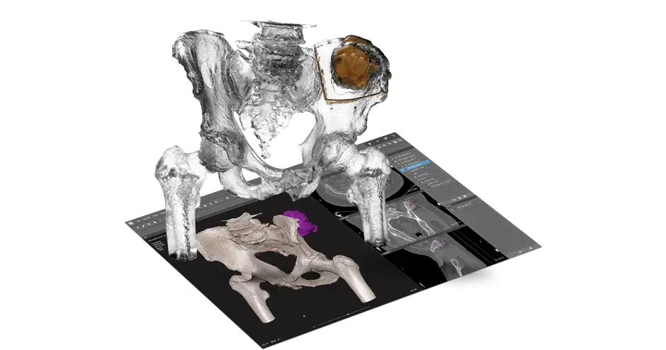 segmentation software image with hip anatomic model
