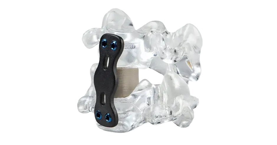 3D printed spinal cage device in PEEK for spinal surgeries 