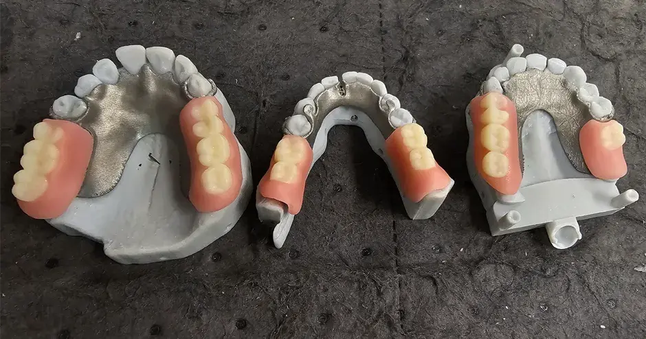 3D printed dentures