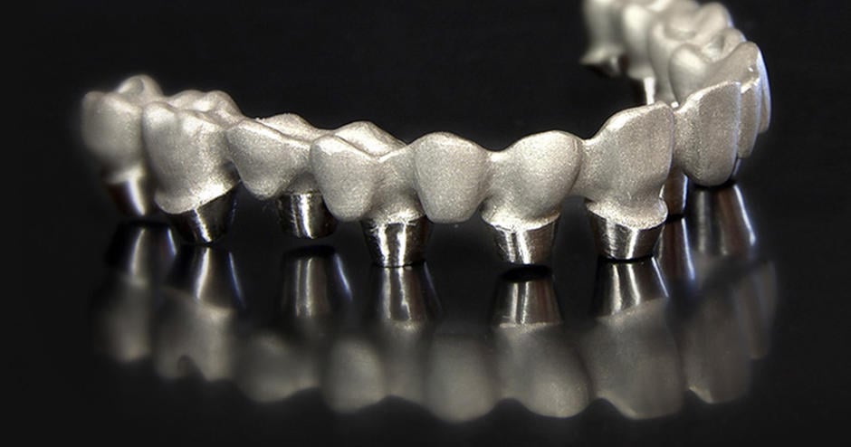 Metal 3D Printing Brings Growth to Dental Lab | 3D Systems
