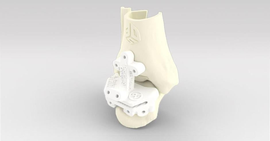 Personalized Care is an Engine for Medical Innovation. 3D Printing is ...